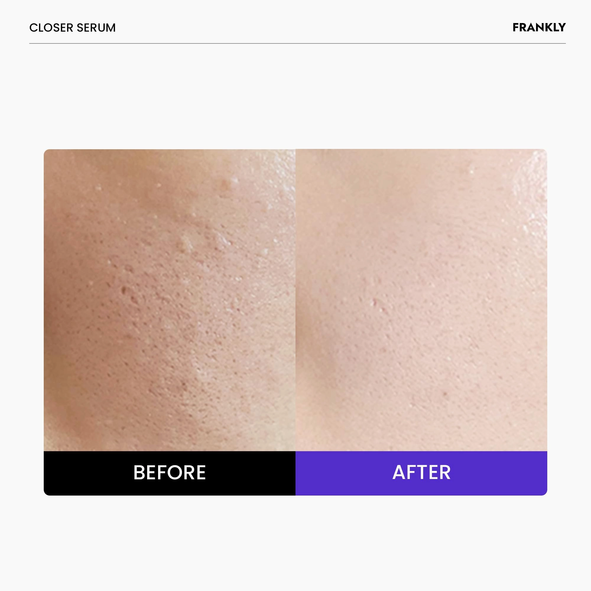 FRANKLY Closer Serum Jumbo | Pore Minimizer Serum | 9 Peptides, Vegan Collagen, Adenosine, PHA | Korean Pore Minimizer for Glass Skin, Anti-Aging, Hydration, Elasticity | 2.03 fl oz