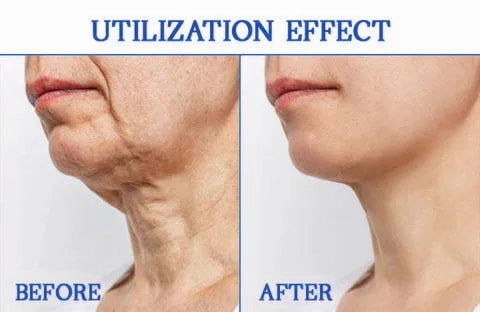 Glossy™ Ultra Firming & Revitalizing Cream (Renew Skin Firmness)