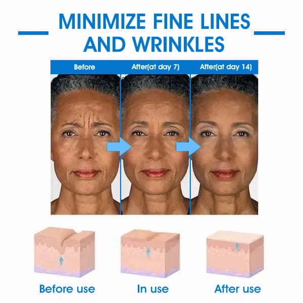 Glossy™ Ultra Firming & Revitalizing Cream (Renew Skin Firmness)