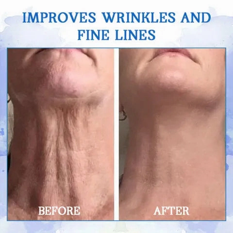 Glossy™ Ultra Firming & Revitalizing Cream (Renew Skin Firmness)