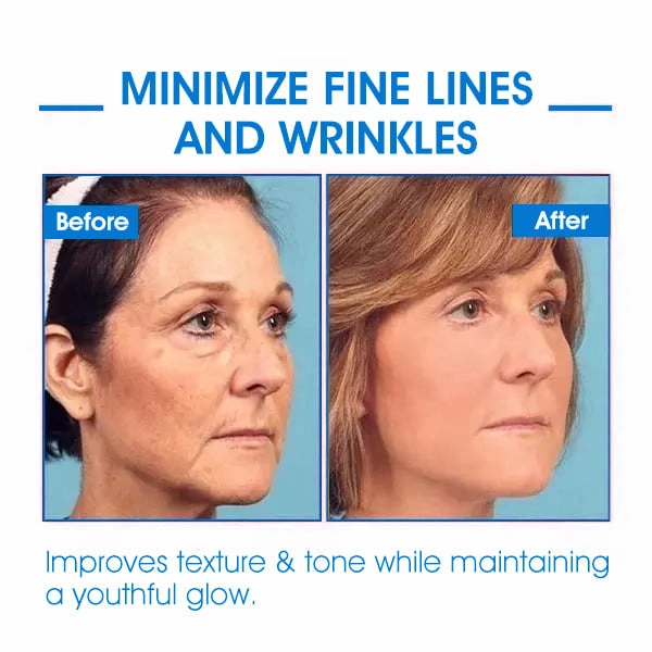Glossy™ Ultra Firming & Revitalizing Cream (Renew Skin Firmness)