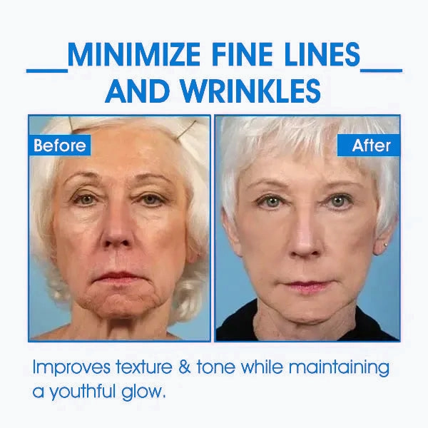 Glossy™ Ultra Firming & Revitalizing Cream (Renew Skin Firmness)