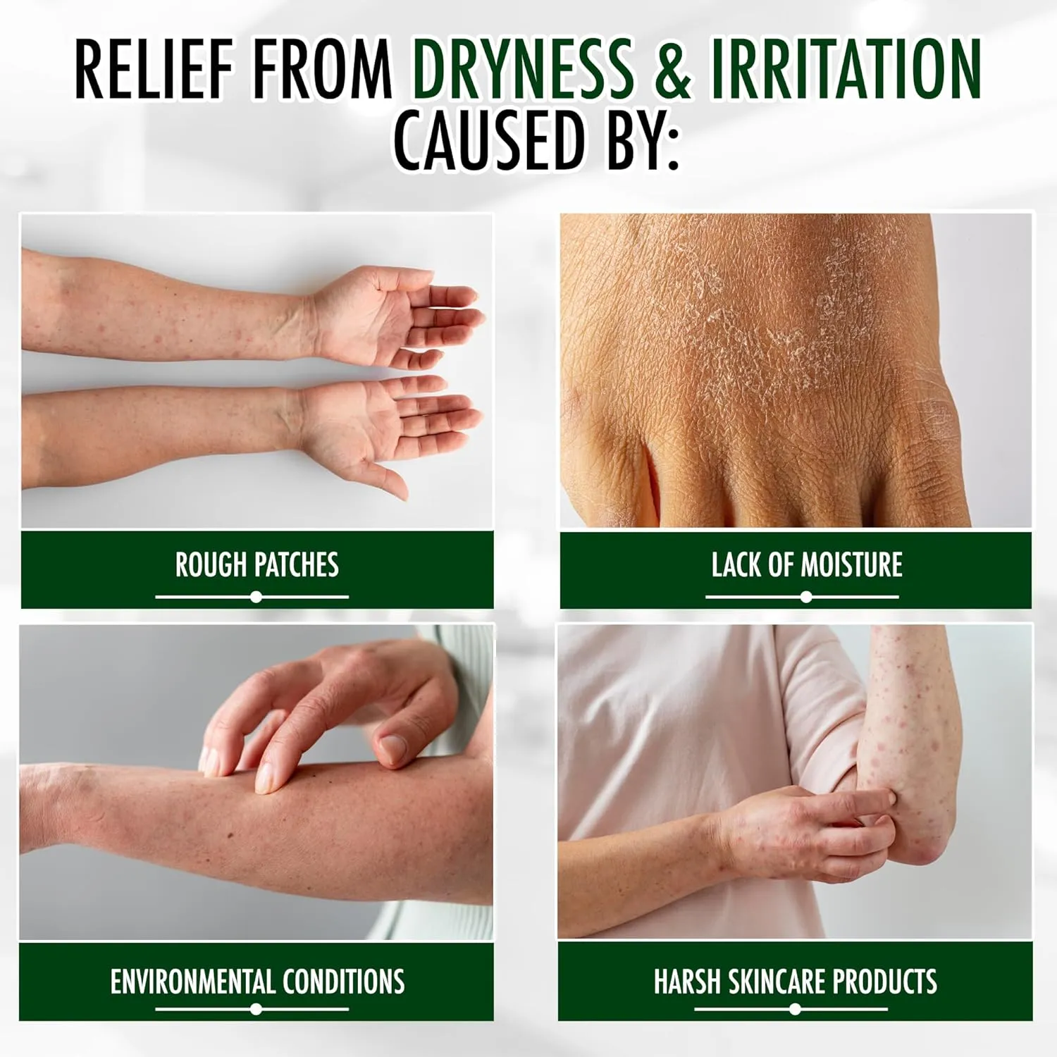 GLY MIRACLE Moisturizing Body Cream Lotion, 12 ounce - Non-Greasy Skin Humectant for Extremely Dry Skin, Hands, Body, and Feet, Fragrance-Free with Pure Glycerin for Nourishing Hydration.