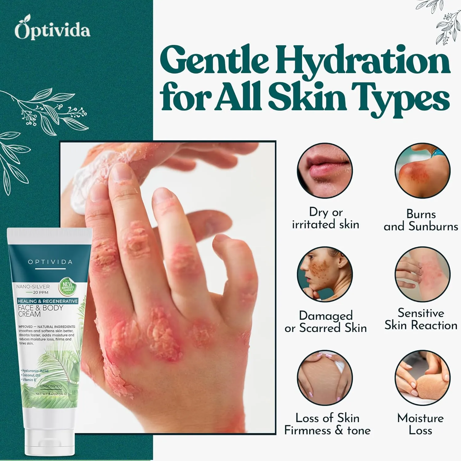 Optivida Nano Silver Skin Healing Cream - Skin Healing Ointment. Hydrating & Healing Topical Solution for Burns, Wounds, Scar, and Acne, Moisturizer Healing Cream
