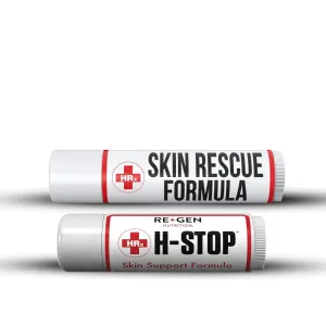 Re Gen Nutrition H Stop Lip Balm & Skin Rescue Formula with 100% Natural Shea Butter, Peppermint Oil, Tea Tree, Lemon Balm, Zinc, Coconut and More for Clear and Healthy Skin Care, 0.5 oz