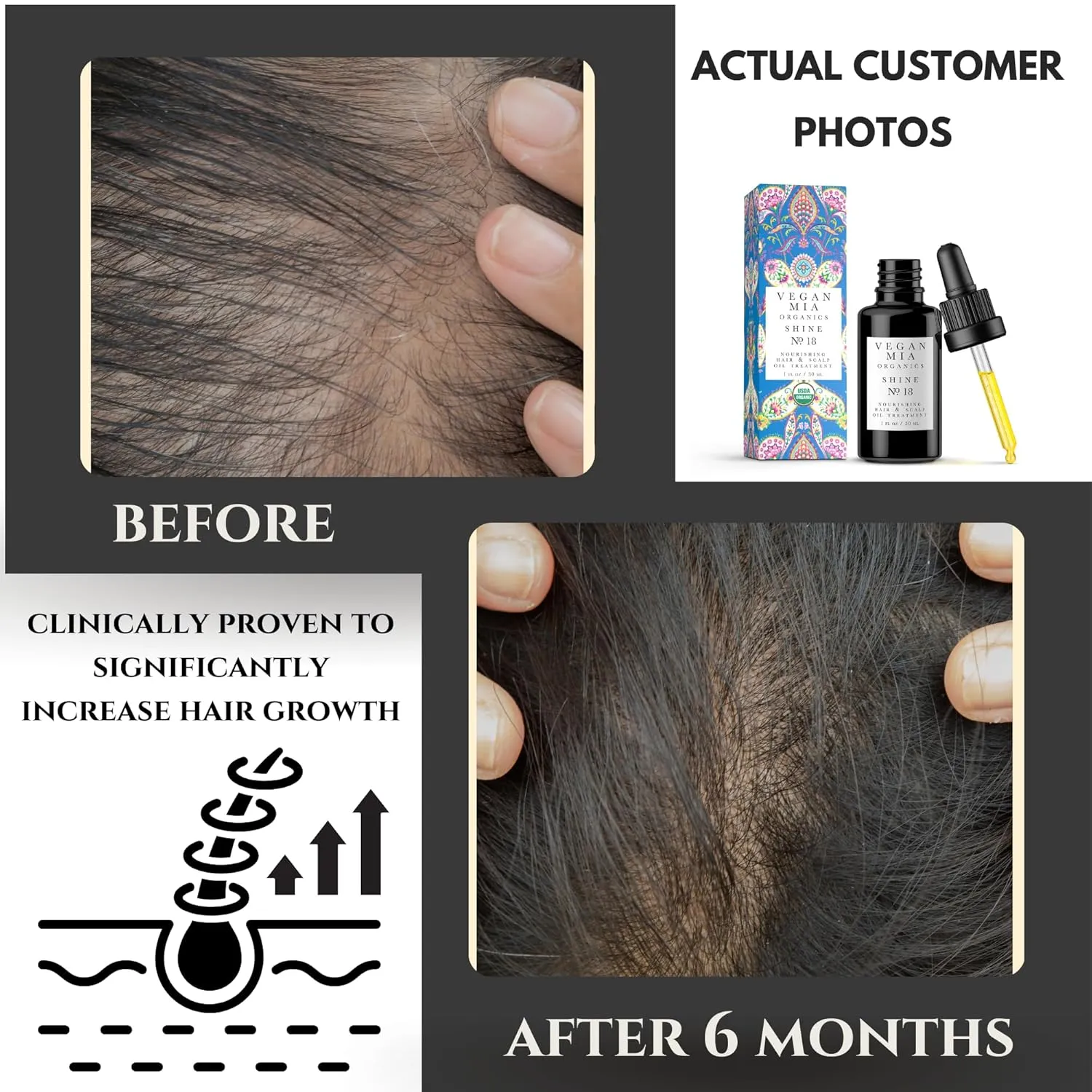 USDA Organic Rosemary Oil for Hair Growth with Castor, Jojoba & More by Vegan Mia | for Intense Nourishment & Dry Scalp Treatment - Get Healthier, Thicker & Shiny Hair Naturally (with Exclusive eBook)